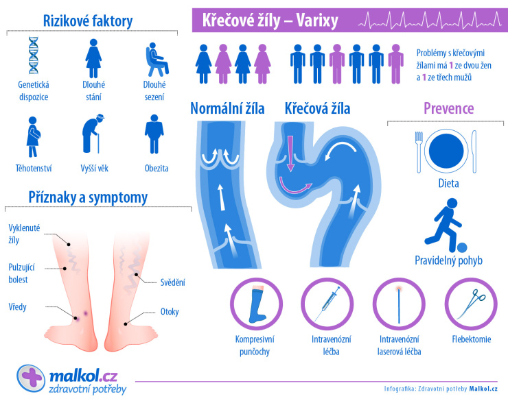 Křečové žíly - varixy - Rizikové faktory - INFOGRAFIKA (článek Malkol.cz)