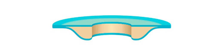 Nový konvexní kroužek Brava® Protective Seal Convex - Malkol.cz Nový konvexní kroužek Brava® Protective Seal Convex
